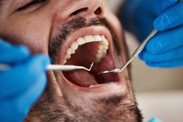 Best Emergency Dental Care for Abscessed Tooth in Woodstock, AL